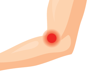UrgenteKineto-10